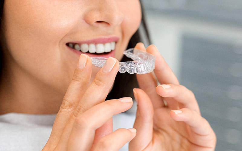 Teeth Aligners Cost